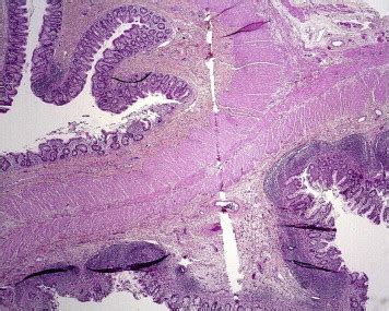 Ileocecal Junction Histology