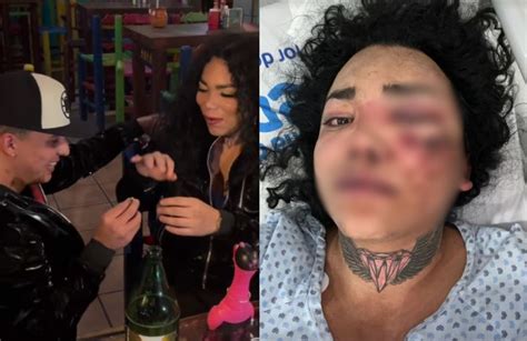 Paola Suárez tras ser golpeada y desde el hospital confirma que