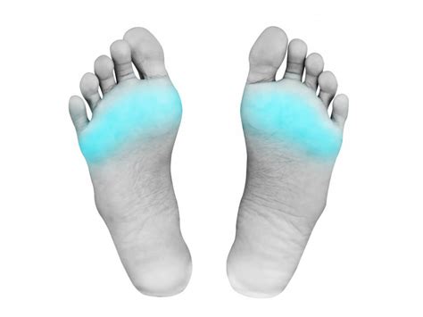 Metatarsalgia – Ball of foot pain - ACE Podiatry