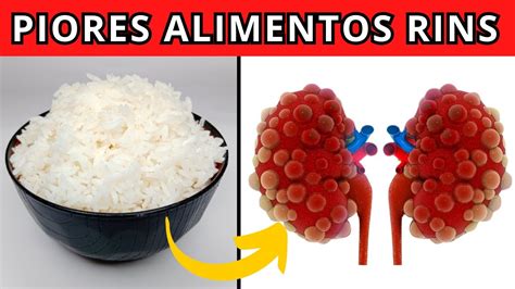 5 Alimentos Prejudiciais para a Saúde dos Rins YouTube