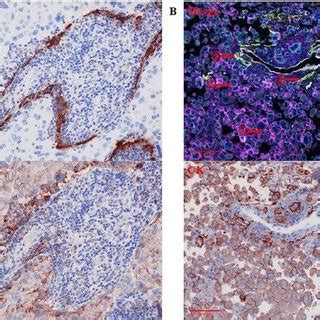 Expression Of PD L1 On Different Cells Stains PD L1 Magenta D2 40