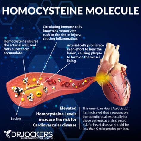 What are Your Homocysteine Levels? - DrJockers.com