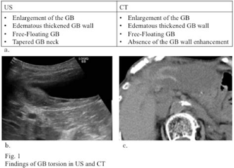 Figure 1 From Mr Findings Of Gallbladder Torsion And Acute Gangrenous Cholecystitis