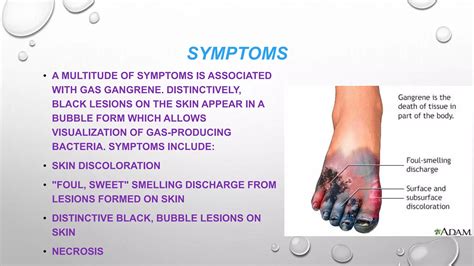 Gas Gangrene Ppt