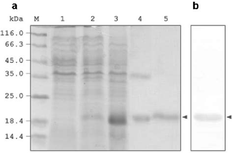 Recombinant Expression Of Mtspla A Sds Poly Acrylamide Gel