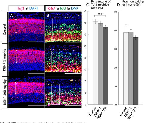 Figure 2 From Prenatal Exposure To Di 2 Ethylhexyl Phthalate Impairs