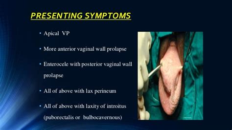 Uterine Prolapse Degrees