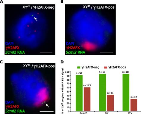 X Chromosome Silencing Is Inefficient In Oocytes Containing A Y