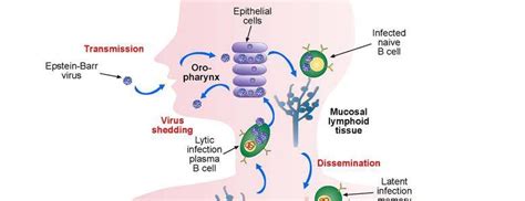 Epstein barr virus – Symptoms , Causes and Treatment – article1000.com