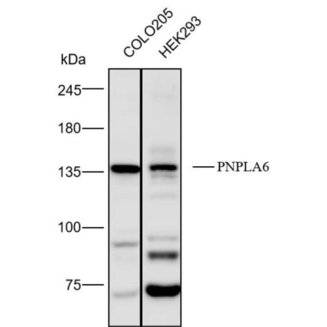 Solarbio K112161P Anti PNPLA6 Polyclonal Antibody 试剂仪器耗材