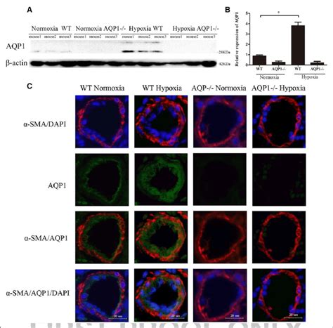 Chronic Hypoxia Exposure Upregulates Aqp Aquaporin Expression In