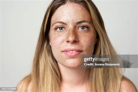 Skin Close Up Freckles Photos And Premium High Res Pictures Getty Images