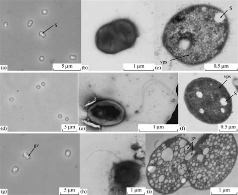 Morphology and ultrathin structure of the cells of purple sulfur... | Download Scientific Diagram