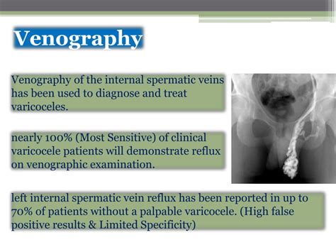 Ppt Varicocele Powerpoint Presentation Free Download Id 245346