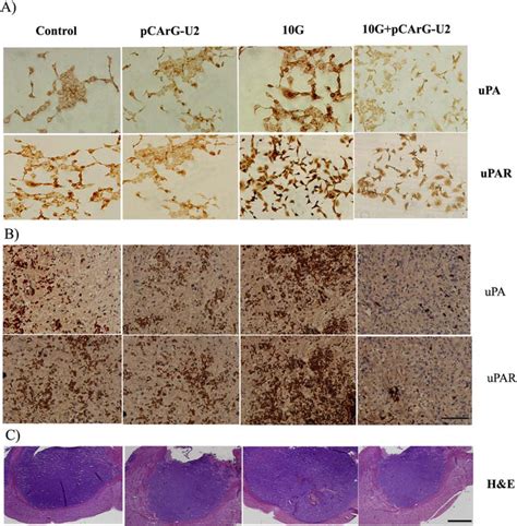 Immunocytochemistry And Immunohistochemistry Reveal Decreased Upa And