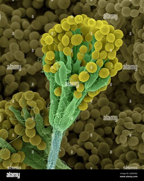 Coloured Scanning Electron Micrograph Sem Of Mould Conidiophores