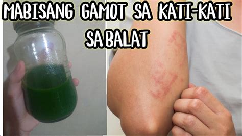 Mabisang Gamot Sa Kati Kati Sa Balat Sugat At Mga Galis Youtube