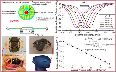 Sensors Free Full Text Review Of Research Status And Development