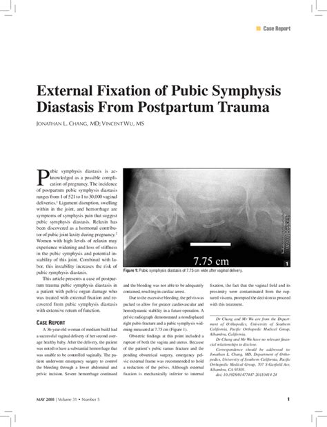 External Fixation Of Pubic Symphysis Diastasis From Postpartum Trauma Orthopedics