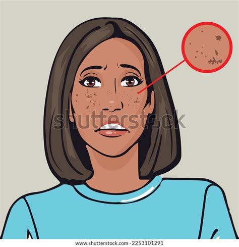 Dark Spots On Face Over 3 830 Royalty Free Licensable Stock Vectors