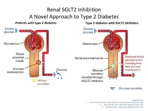 SGLT-2 Inhibitors – Diabetes Daily