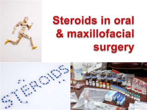 Steroids In Oral And Maxillofacial Surgery