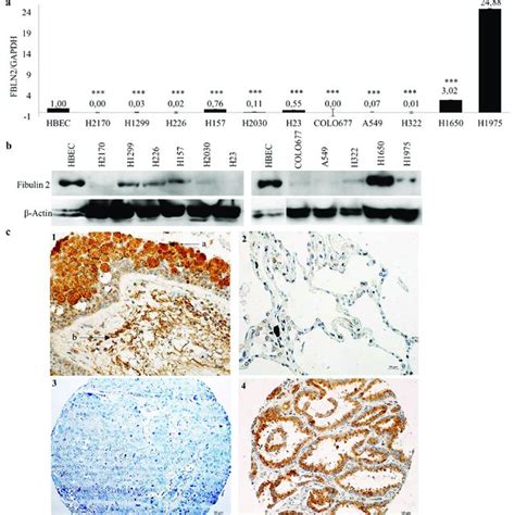 Fbln Expression In Human Lung Cancer Cell Lines Normal Lung Tissue