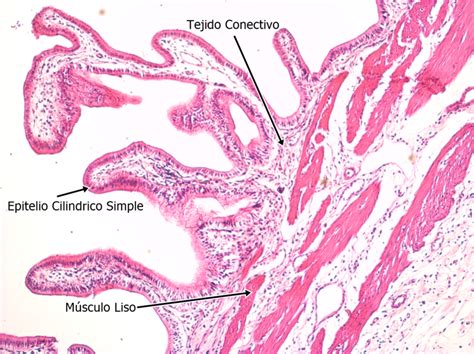 Epitelio Pseudoestratificado Cilindrico 2 5x 5x 10x 20x 40x