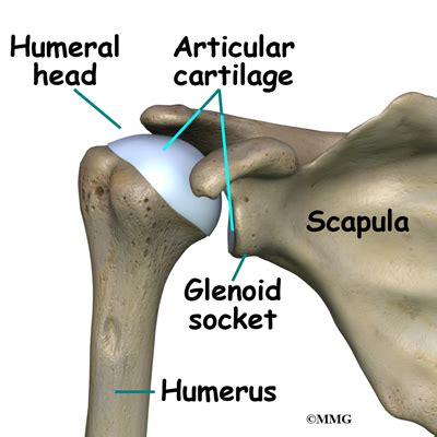 Osteonecrosis of the Humeral Head - eOrthopod.com