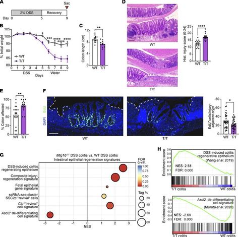 Jci Insight Mtg16 Regulates Colonic Epithelial Differentiation