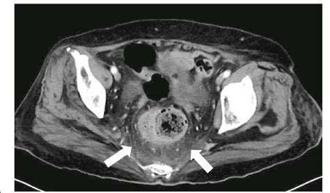 Abdominal Contrast Enhanced Computed Tomography Ct And Download Scientific Diagram