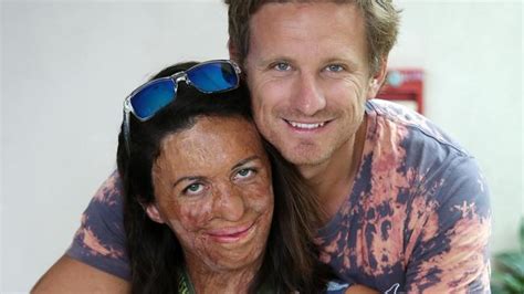 Turia Pitt Says Hawaiian Ironman Triumph ‘was For Me And My Demons