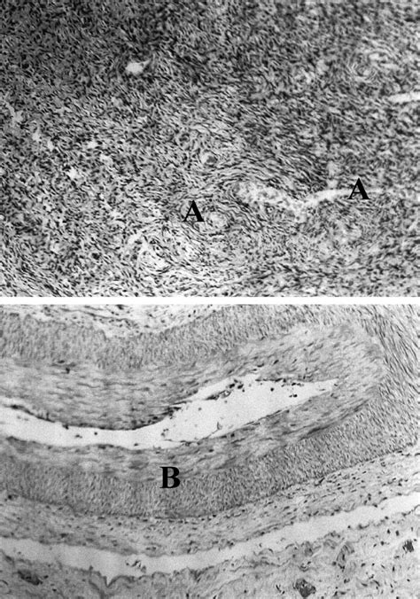 Histology of human ovary. Ovarian tissue sections show follicles at... | Download Scientific Diagram