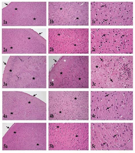 Adult Male Brain Histopathology 1a C Group Pia Mater Arrow