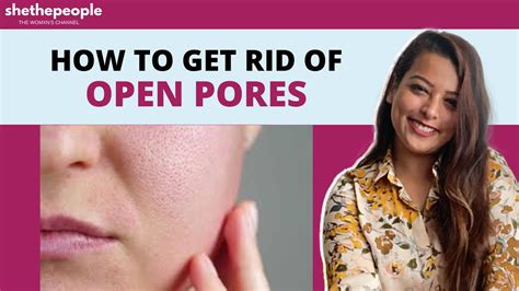 How To Treat Open Pores Answers Dr Pranami Kashyap Youtube