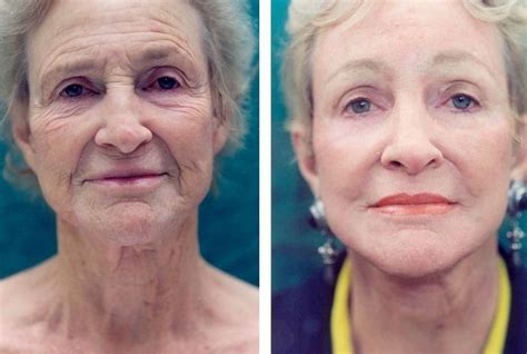 Facelift Toning Workouts To Renew Your Neck And Face Best Face