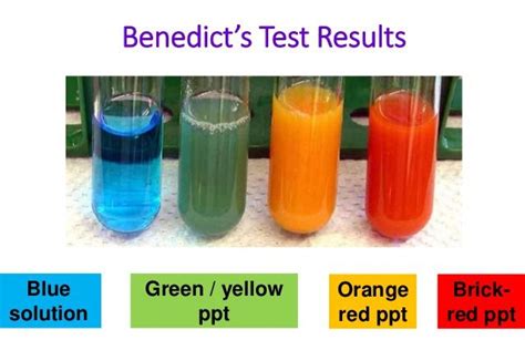 Benedict S Test For Reducing Sugar Medical Study Zone