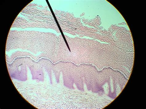 Stratified Squamous Epithelium Under Microscope