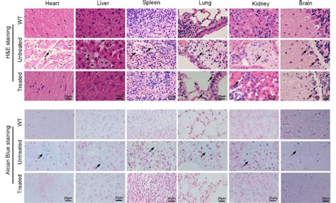 In Vivo Base Editing Corrects Histological Abnormalities In MPS IH