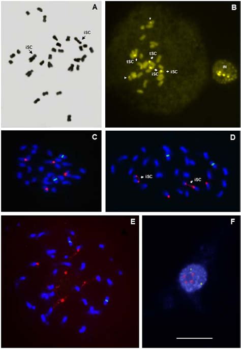 A Feulgen Metaphase Plate Showing Chromosome Pair With Intercalary