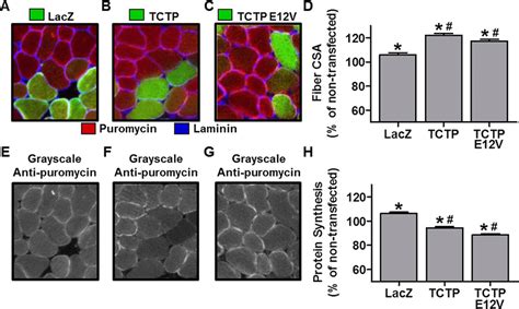 The Effect Of Tctp Overexpression On Muscle Fiber Cross Sectional Area