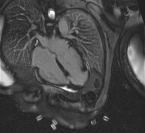 risonanza magnetica cardiaca Sanità Digitale