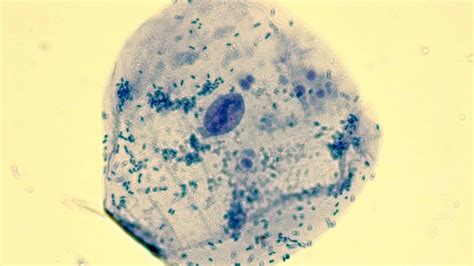 How To Look At Cheek Cells Under A Microscope A Step By Step Guide