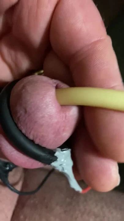 Electrocum Around 22 Fr Catheter Gay BDSM Porn Feat Electrikinky XHamster