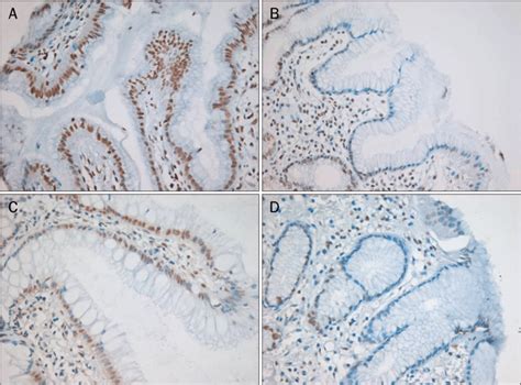 Immunohistochemistry For H Ax And Phospho Bp Proteins Were Detected