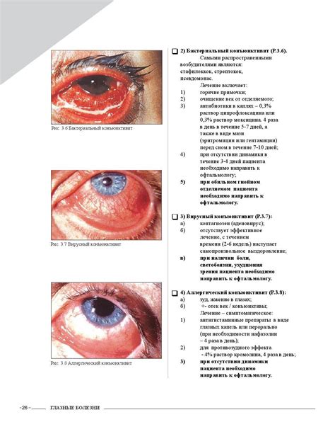 Глазные болезни - симптомы и лечение заболеваний и инфекций глаз
