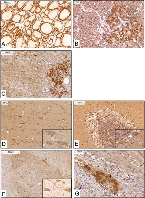 Klotho Protein Expression And Distribution In Human Endocrine And