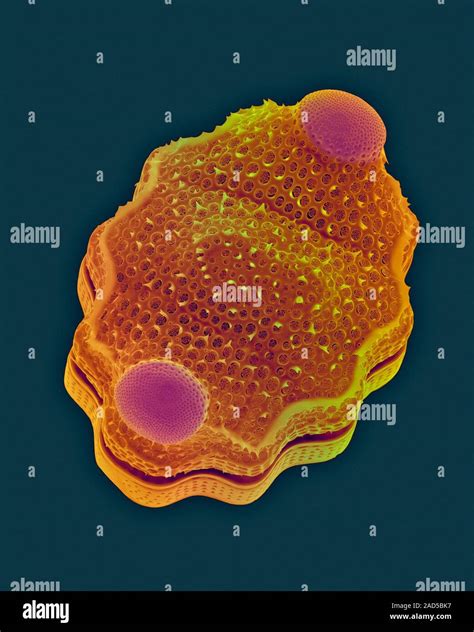 Coloured Scanning Electron Micrograph Sem Of Marine Centric Diatom