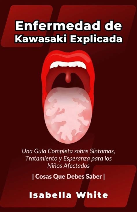 Enfermedad De Kawasaki Explicada Una Guía Completa Sobre Síntomas