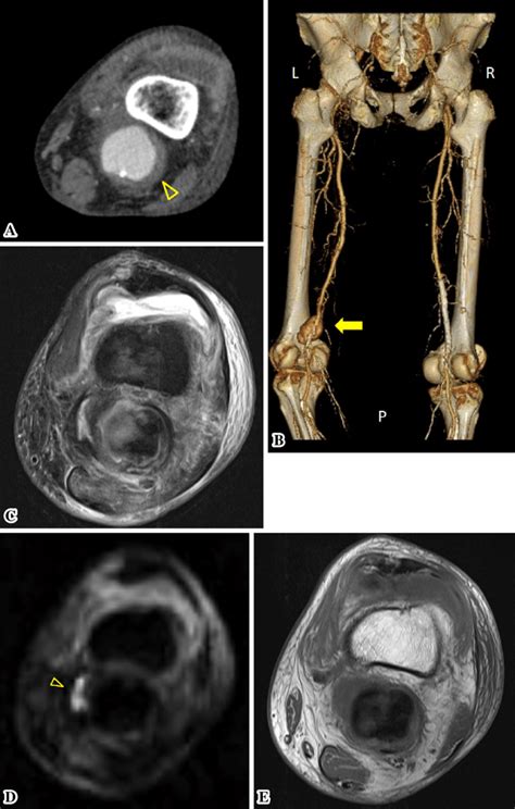 Figure Ct And Magnetic Resonance Imaging Mri Findings Of The